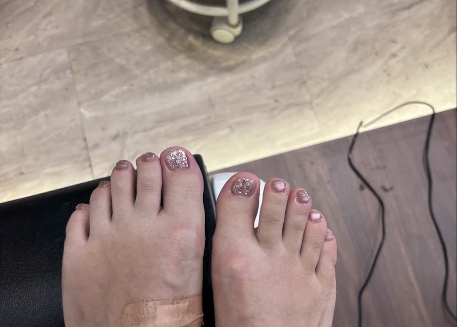 The C Nails